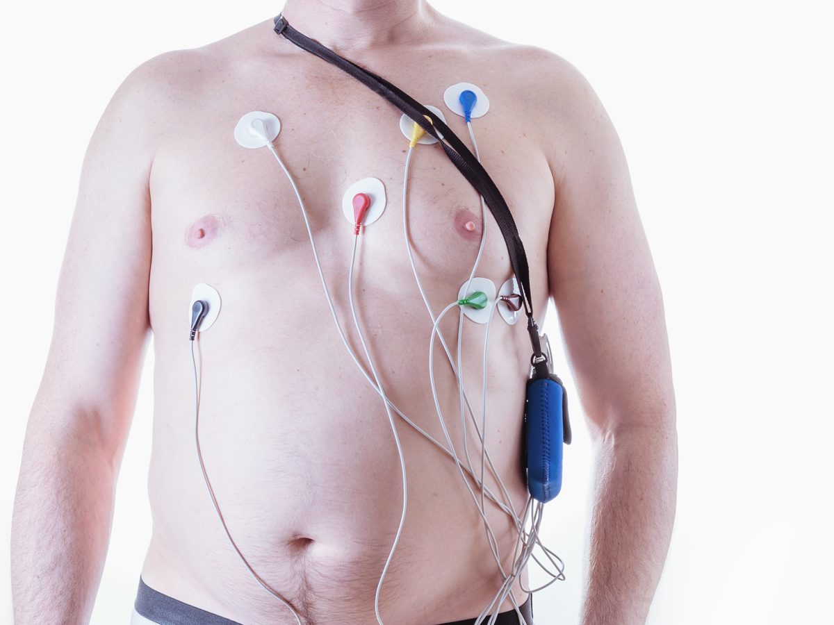 Paciente com eletrodos e gravador de Holter 24 horas no peito